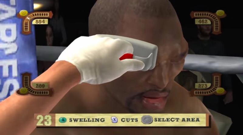 Illustration for article titled A Pro Fighter's Best Friend Is The Guy Who Stops The Bleeding